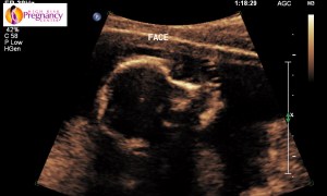 1.2.840.113663.1500.1.379860825.3.28.20150505.124408.687.ac35bda9be4.0000000000